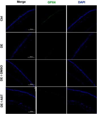 Astaxanthin activated the SLC7A11/GPX4 pathway to inhibit ferroptosis and enhance autophagy, ameliorating dry eye disease